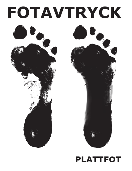Plattfot fotavtryck