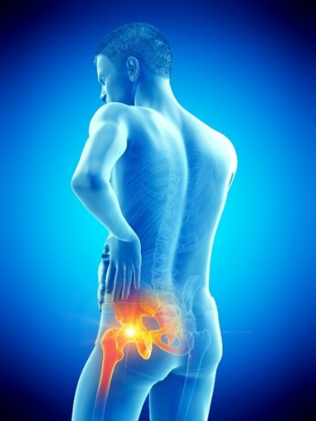 Smarta hoften lopning