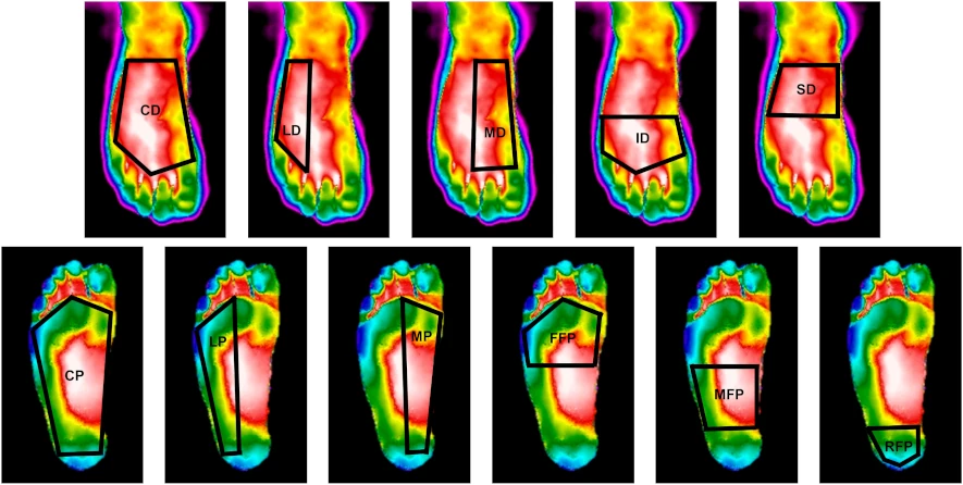 Termografisk bild som visar temperaturförändringar i foten vid olika snörning