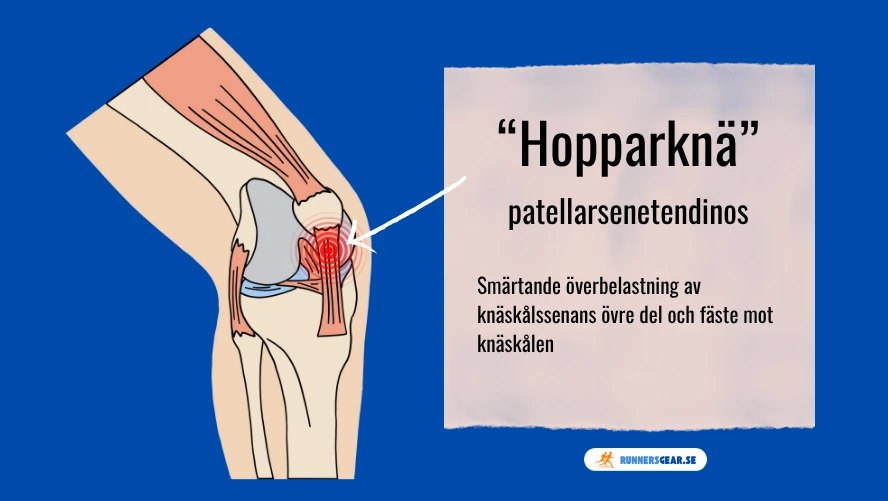 schematisk bild visar knäskålen och var smärtan sitter vid hopparknä